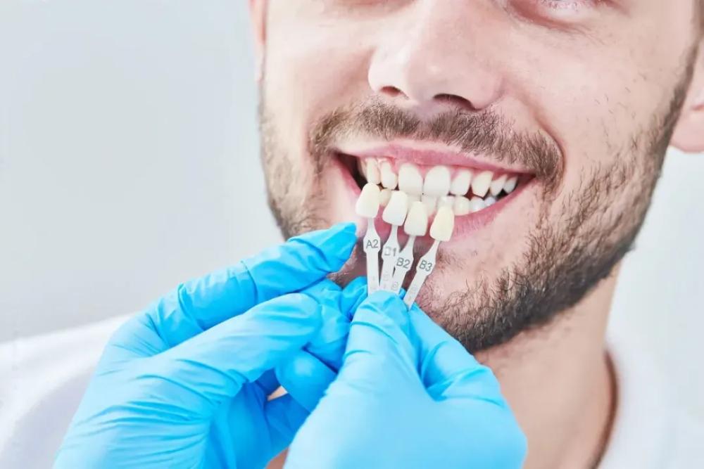 Dental Implants Alfred Cove