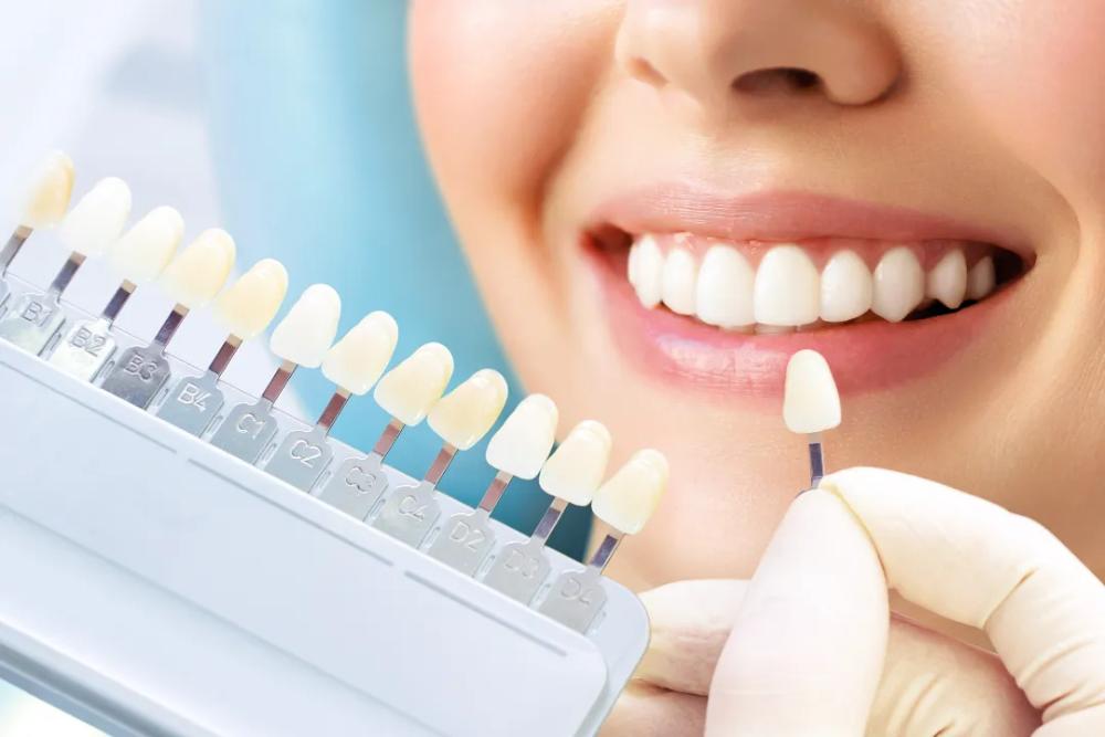 Dental Implants Winthrop