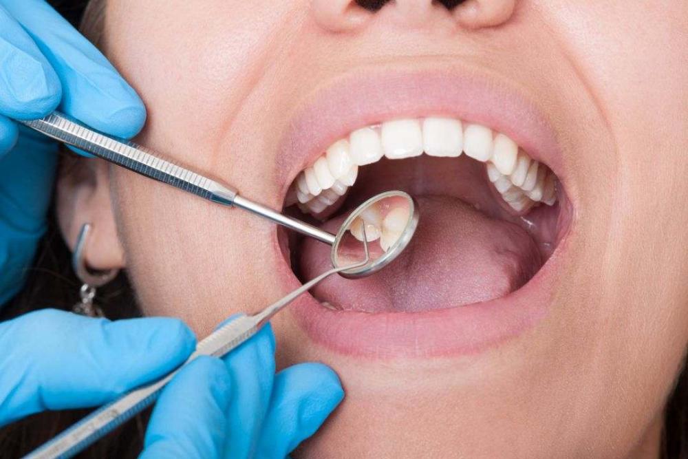 Dentist Mount Pleasant Dentist Mount Pleasant