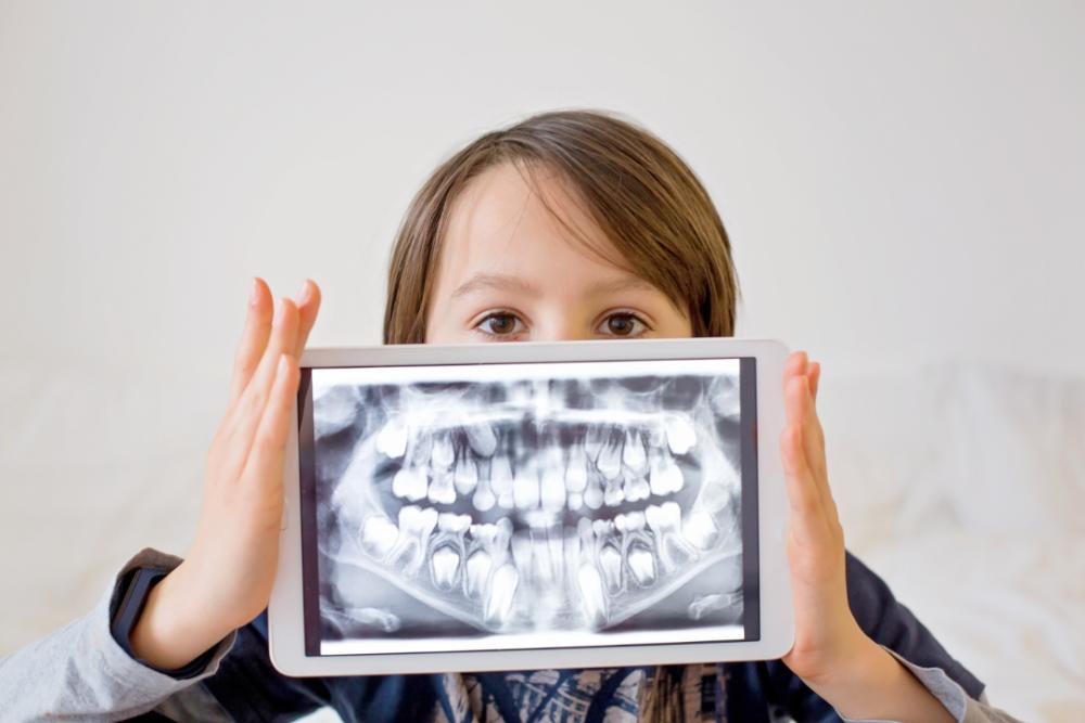 Wisdom Teeth Removal South Perth Wisdom Teeth Removal South Perth